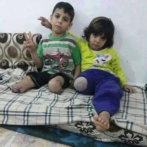 Palestinian children maimed in Gaza